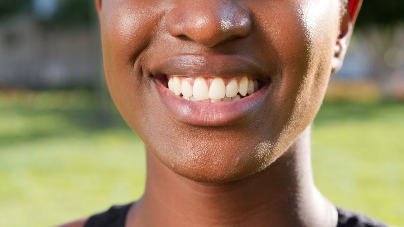 What Your Lip Shade May Indicate About Your Health